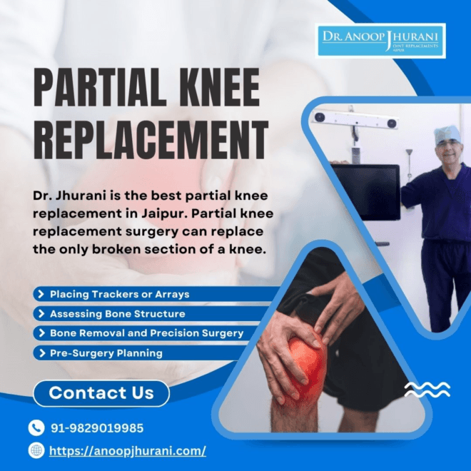 Procedure for Partial Knee Replacement by Dr. Anoop Jhurani