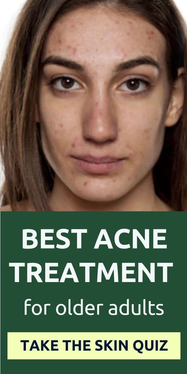 Clinical Approach to Treating Persistent and Severe Acne