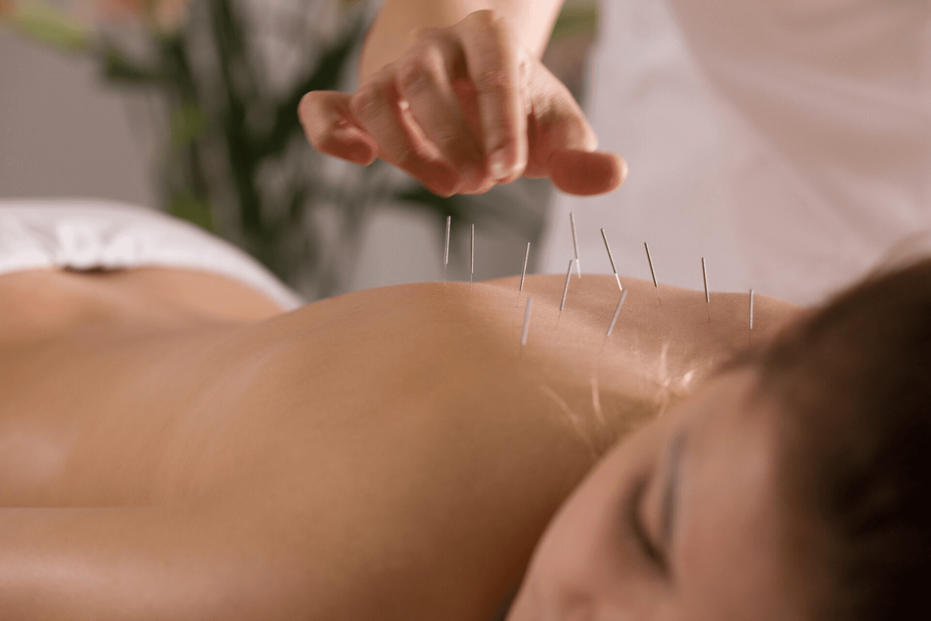 Acupuncture For Sciatica NYC