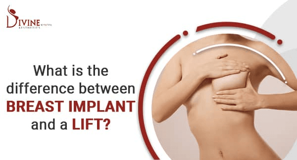Breast Implant Vs Breast Lift