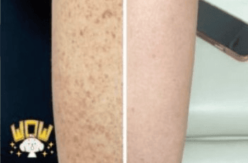  Revitalize Your Skin and Sculpt Your Body at Sadhna Wellness Center
