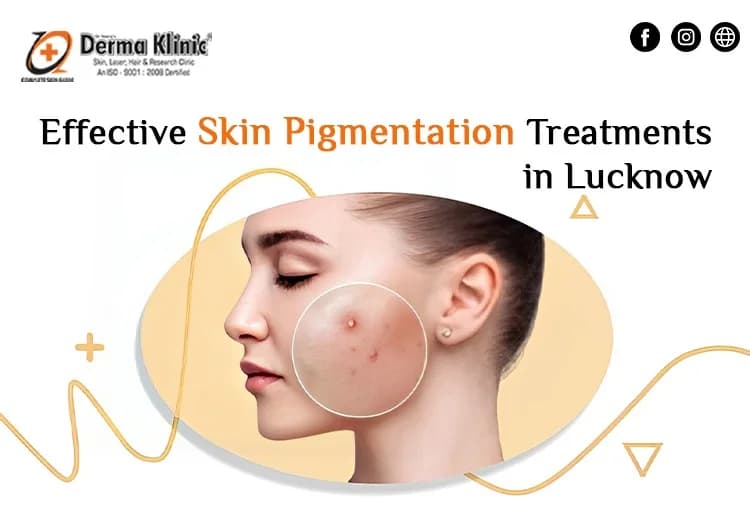 Best Dermatologist In Lucknow For Pigmentation