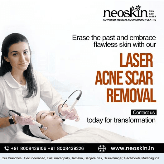 Scar removal treatment in Hyderabad | Neoskin Clinic