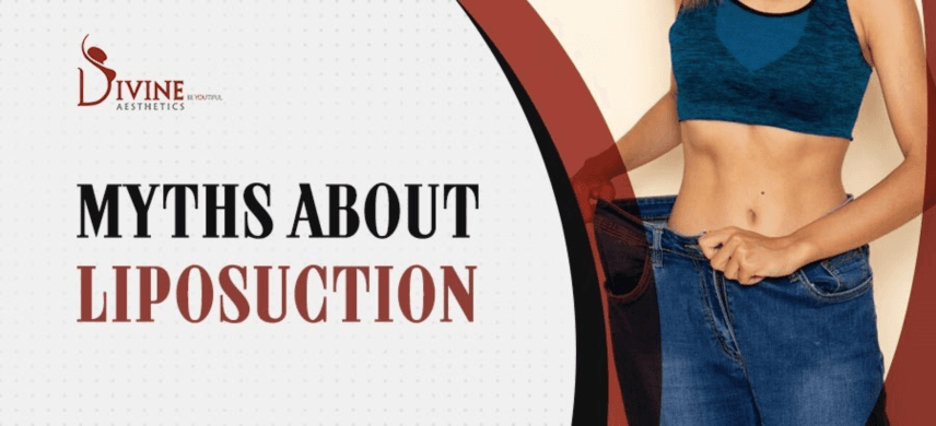 Myths About Liposuction