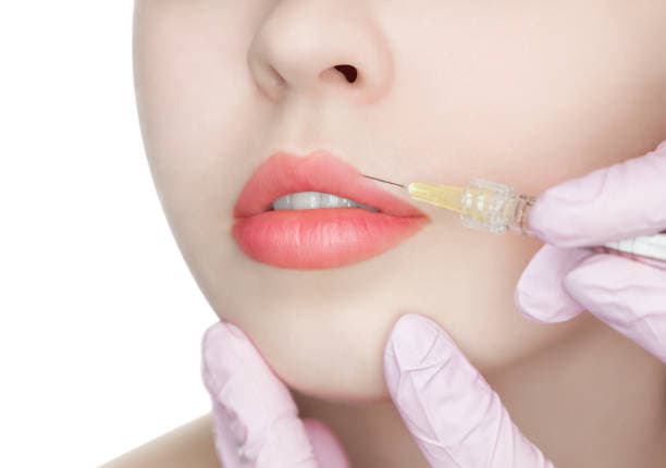 Lip Filler Injections and Aftercare Best Practices