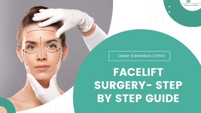 A Guide to Facelift For Men