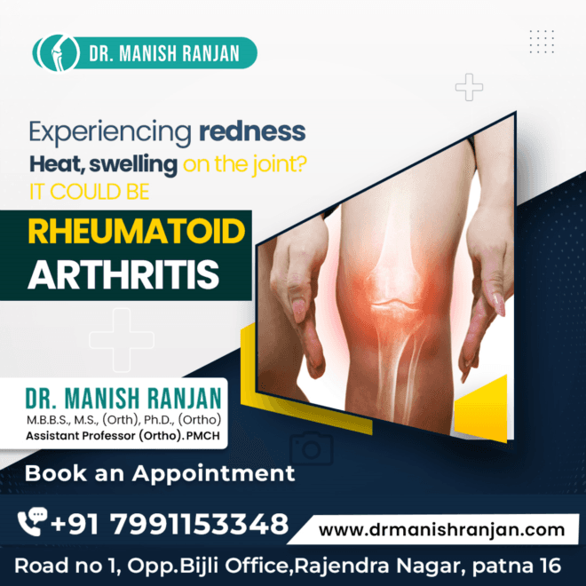 Best Orthopedic Surgeon in Patna | Dr Manish Ranjan