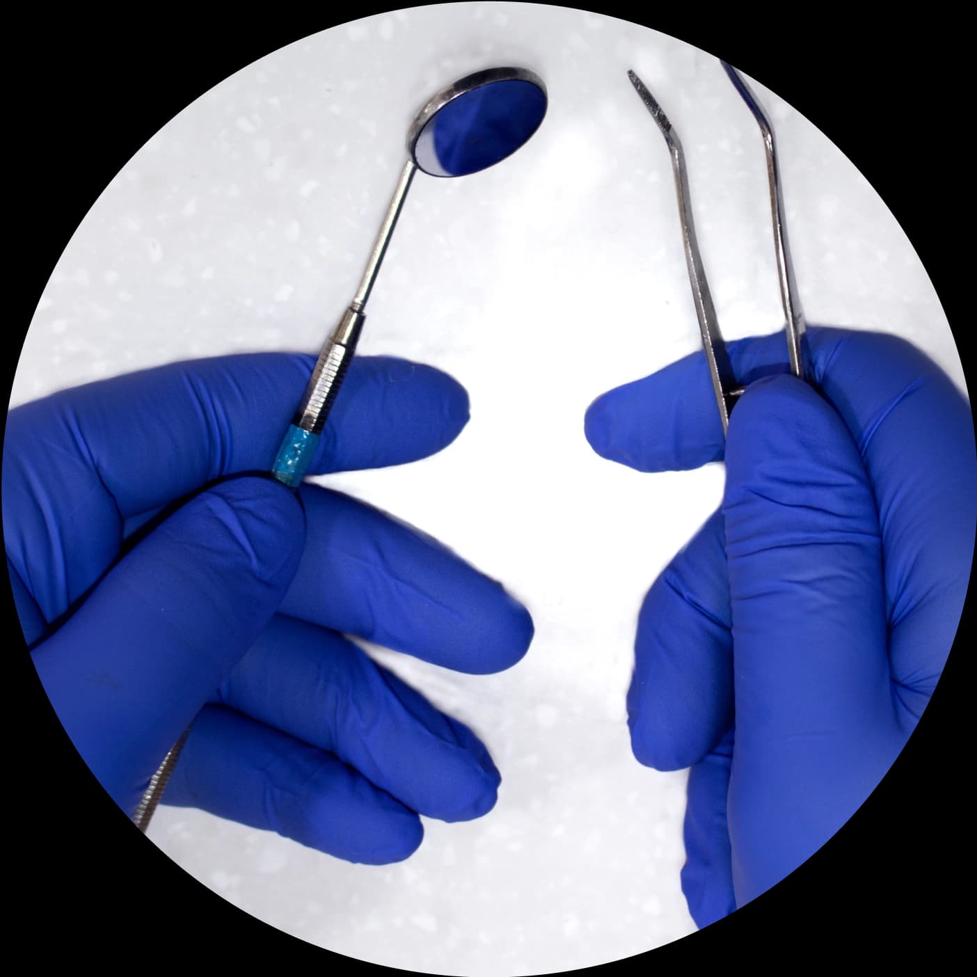 Understanding Ceramic Veneers Cost in Kuwait