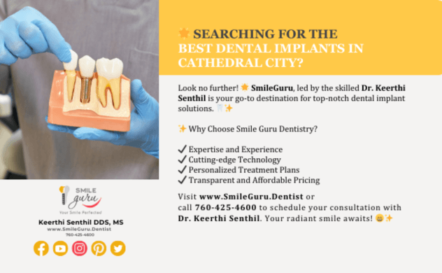 A Comprehensive Guide to Best Dental Implants in Cathedral City