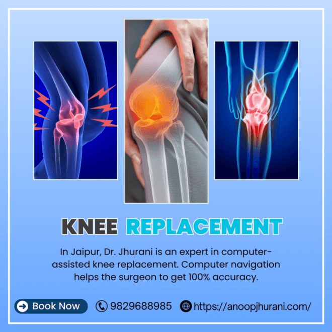 Enhancing Knee Replacement Surgery with Computer Navigation