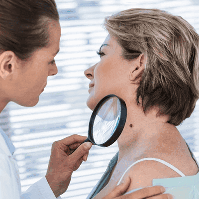 What a Dermatologist Examines for Hair Loss