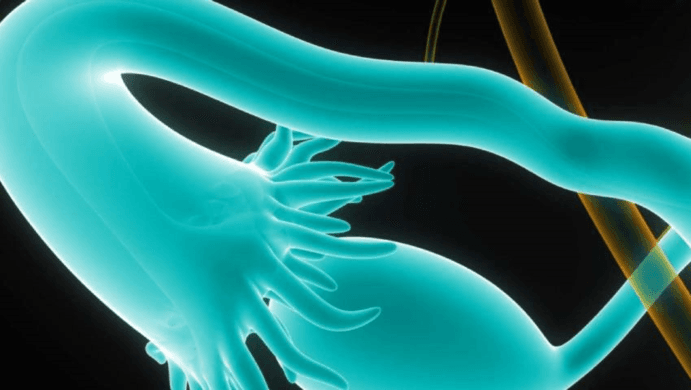 Hope for Pregnancy: What You Need to Know About Blocked Fallopian Tubes