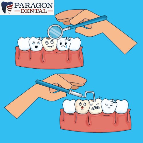 Curing Gum Disease: A Comprehensive Guide to a Healthy Smile