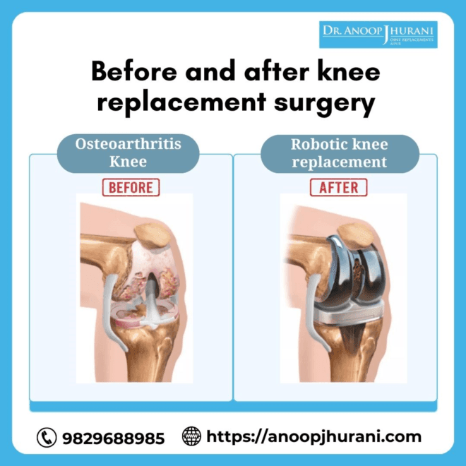 https://anoopjhurani.com/contact/
