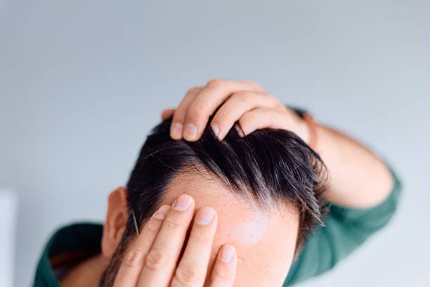 Exosomes Therapy for Hair Loss in Riyadh
