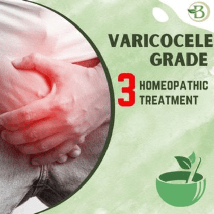 Non-Invasive Breakthrough: Varicocele Treatment Without Surgery Offers Effective Relief