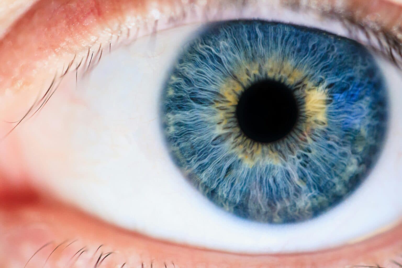 Cataract removal surgery
