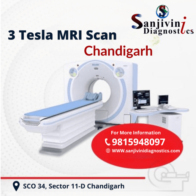 Precise Diagnosis with Full Body MRI at Sanjivini Diagnostics, Chandigarh