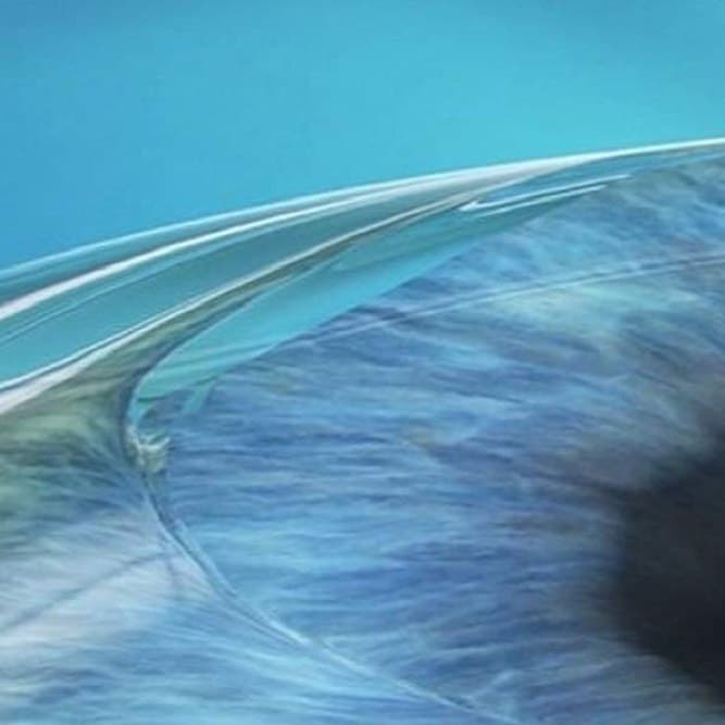 Opération laser yeux Marseille
