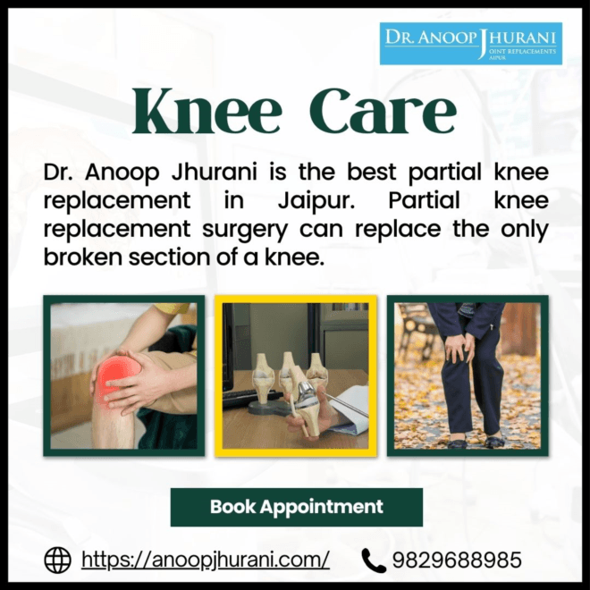 The Benefits of Partial Knee Replacement Surgery
