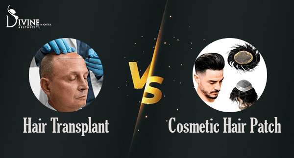 Hair Transplant vs Cosmetic Hair Patch Which is Better?