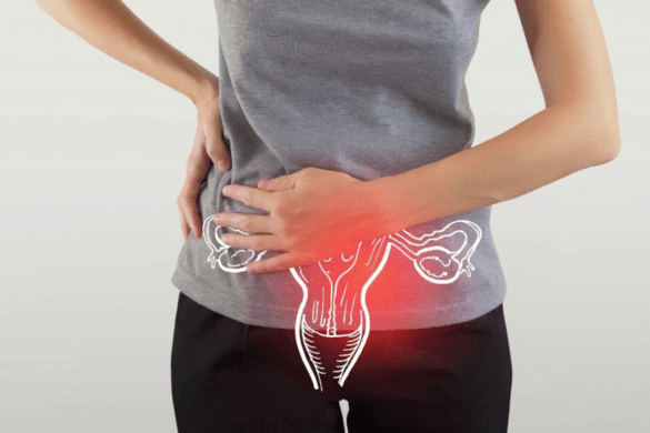 How To Diagnose And Treat PCOS / PCOD