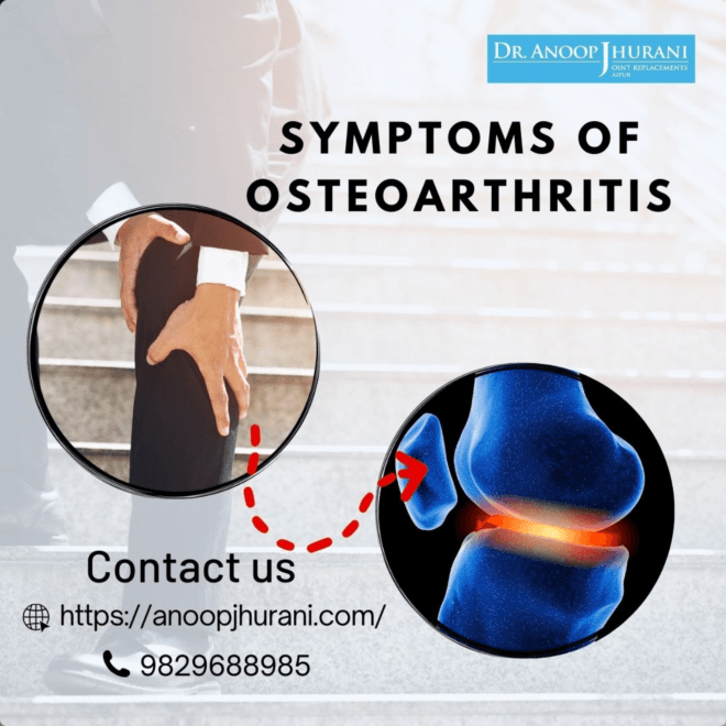 Role of Total Knee Replacement Surgery