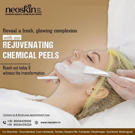 Skin treatment clinic in Madhapur,Hyderabad | Neoskin Clinic 