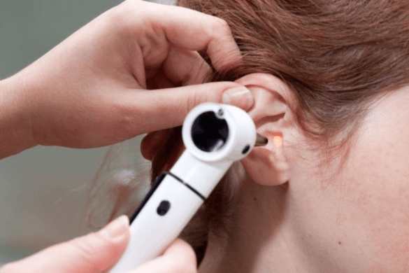 Understanding The Ear Microsuction Process: What To Expect During Your Appointment