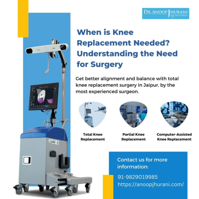 When is Knee Replacement Needed? Understanding the Need for Surgery