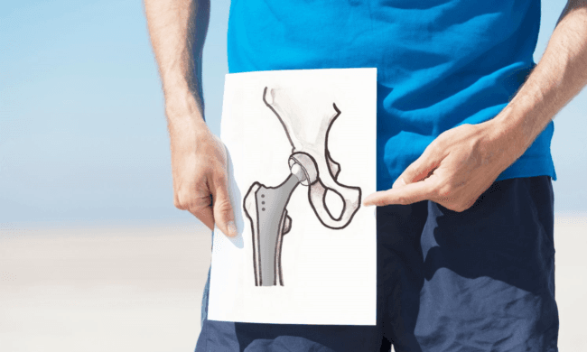 Choosing the Best Hip Replacement Surgeon in Delhi/NCR: A Comprehensive Guide to a Pain-Free Life