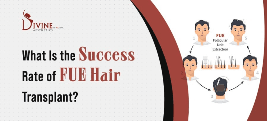 What is the Success Rate of FUE Hair Transplants?