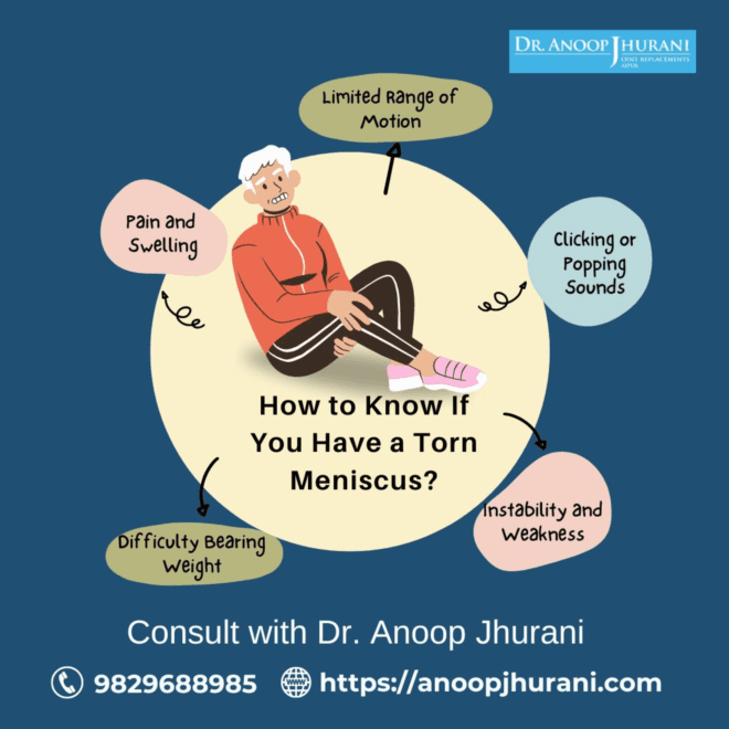 How to know if you have a torn meniscus?