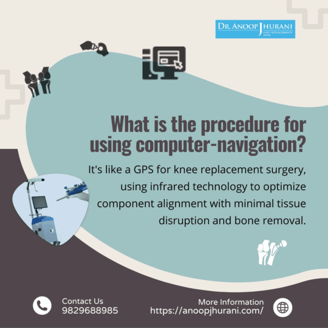 Exploring Computer Navigation in Knee and Hip Replacement