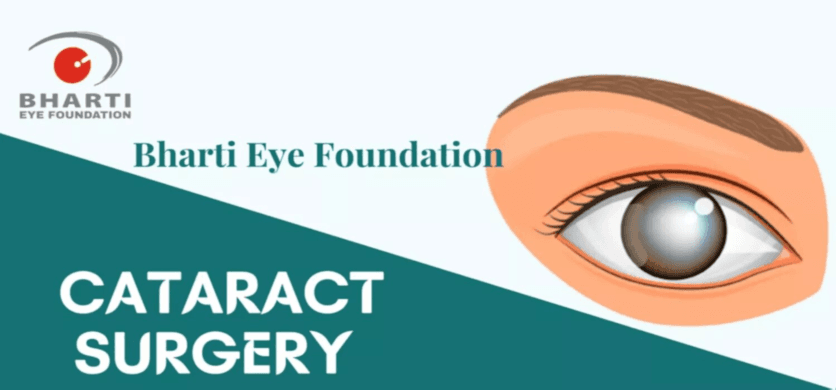 Best Cataract Surgery in West Delhi