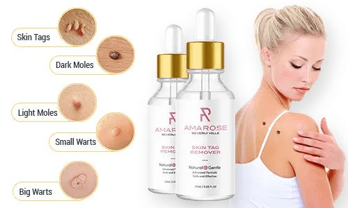 Amarose Skin Tag Remover Reviews