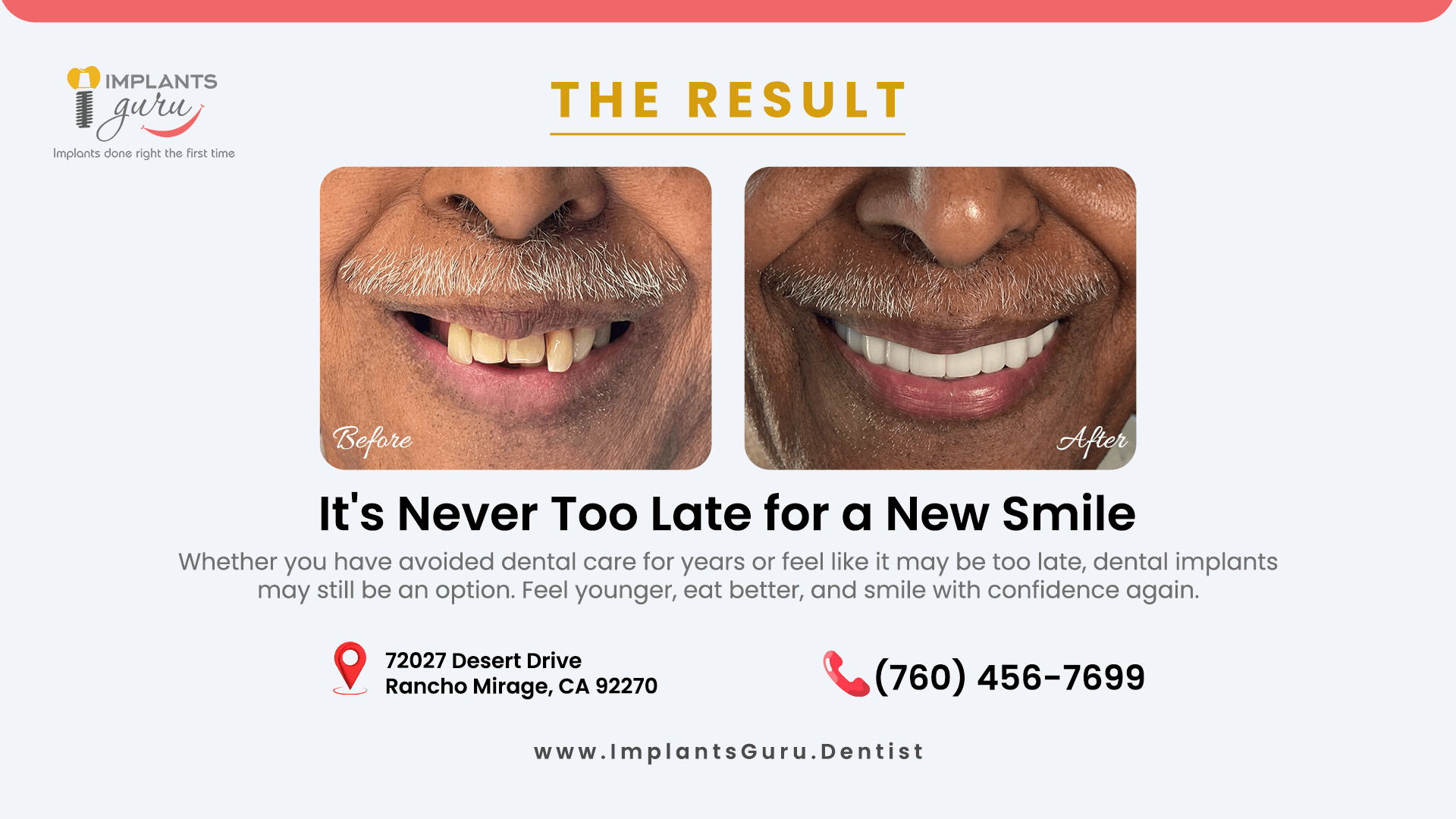 Dental Implants Can Restore Confidence at Any Age