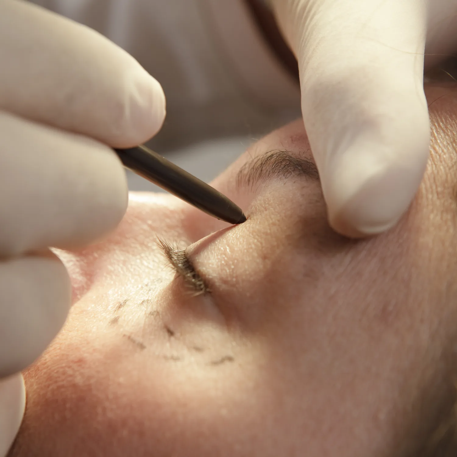 Aesthetic Surgery in Jaipur by Dr. Aakansha Vashistha