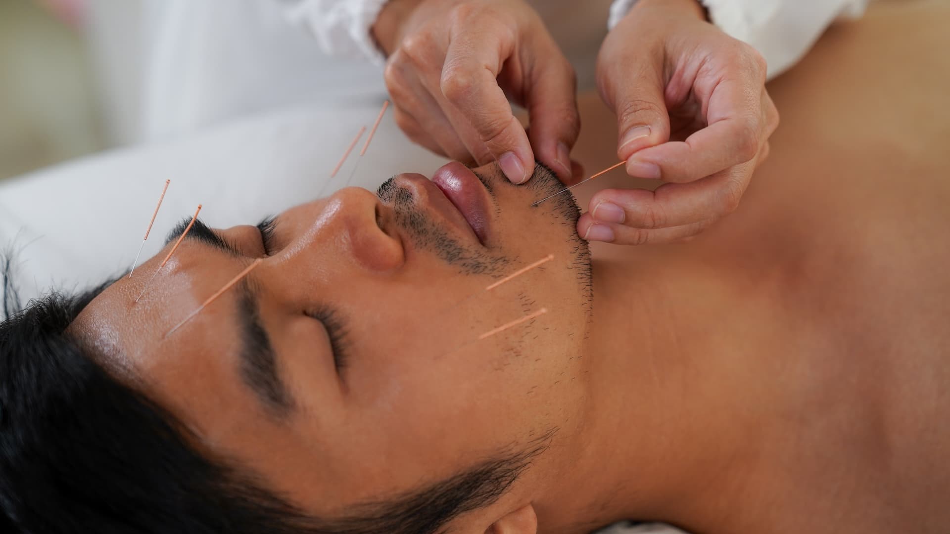 Affordable Holistic Facial Acupuncture in Philadelphia