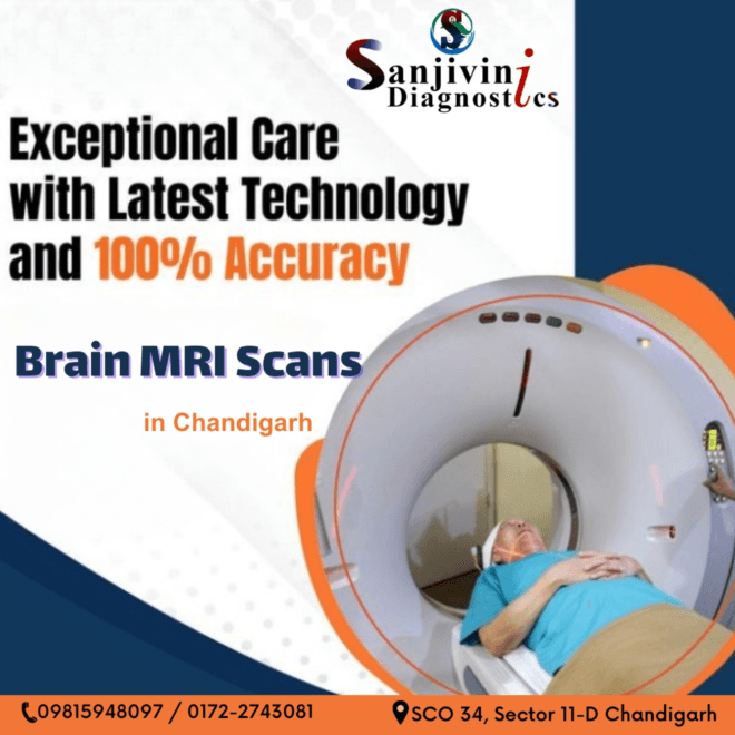 "State-of-the-Art Brain Imaging: Sanjivini Diagnostics in Chandigarh"