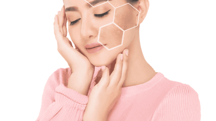 Advanced Pigmentation Treatments for Radiant Skin