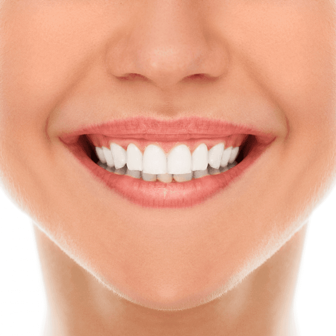 Top Tips for Maintaining a Healthy Smile in Clyde North